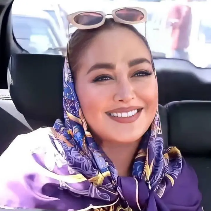 صورت پف کرده الهام حمیدی پس از جراحی زیبایی | الهام حمیدی سوژه شد