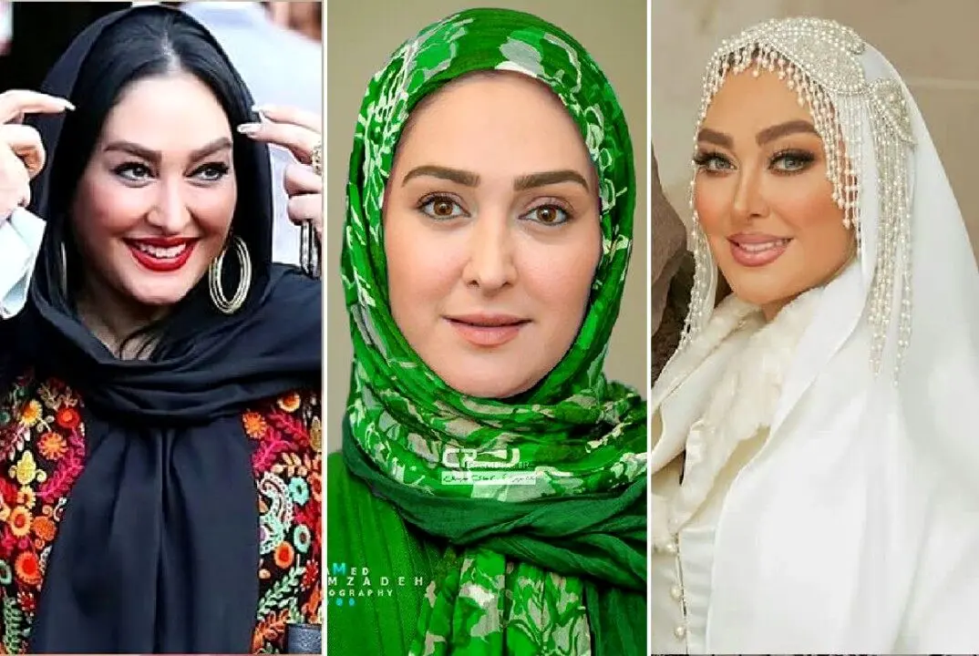 چهره پف کرده الهام حمیدی غوغا کرد | الهام حمیدی در لباس عروس با اضافه وزن شدید